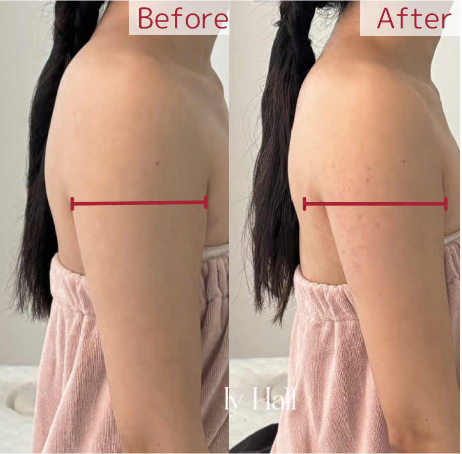 レッドショット　B&A