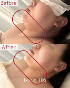 レッドショット　B&A２