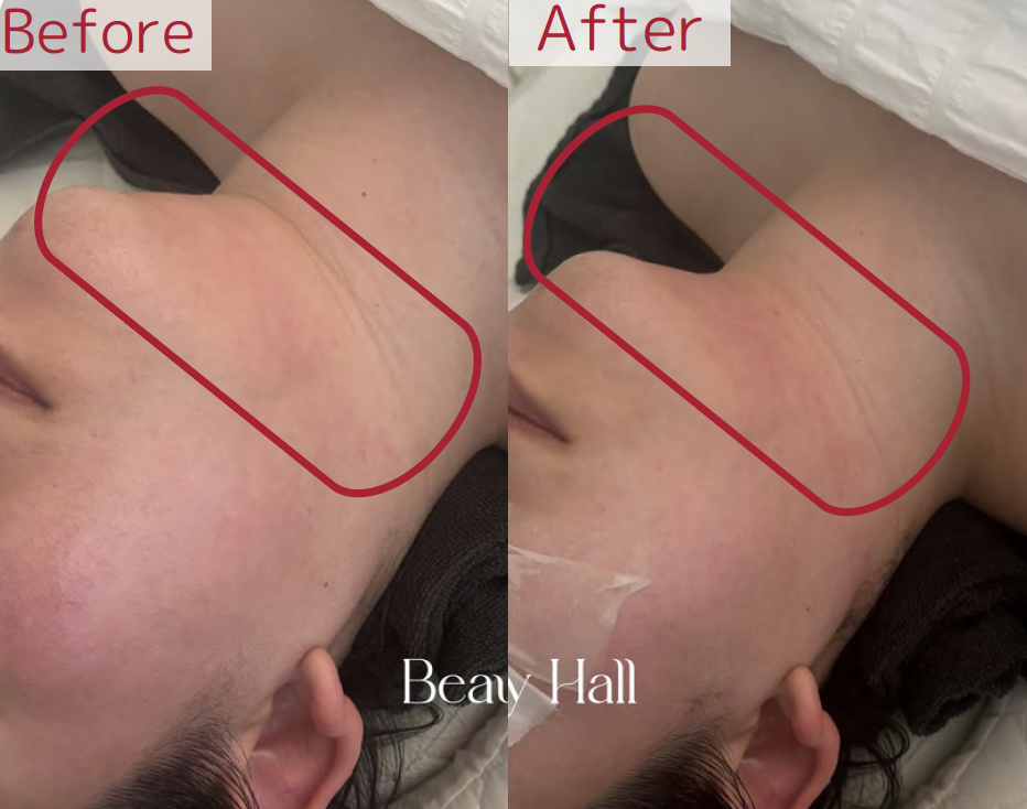 レッドショットB&A