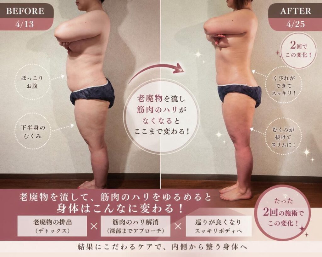 EXSOLEAN, エクソリーン, 痩身クリーム, ノンF, 仕入れ
