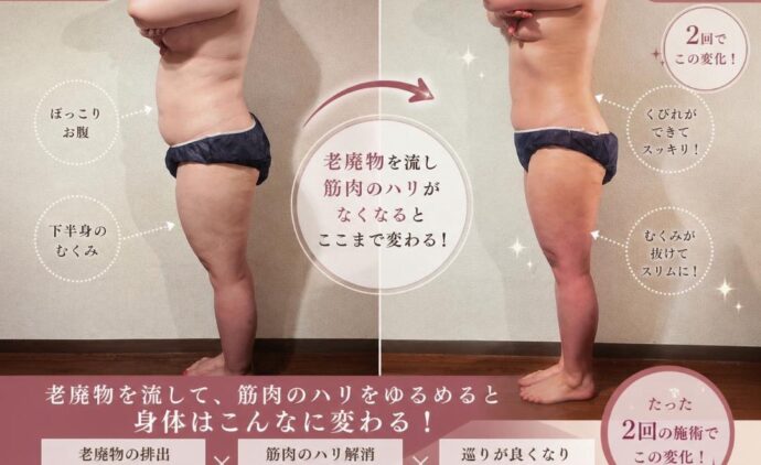 EXSOLEAN, エクソリーン, 痩身クリーム, ノンF, 仕入れ