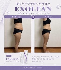 エクソリーン, 痩身クリーム, マッコイ, ノンF, ノンF開発者　新居理恵